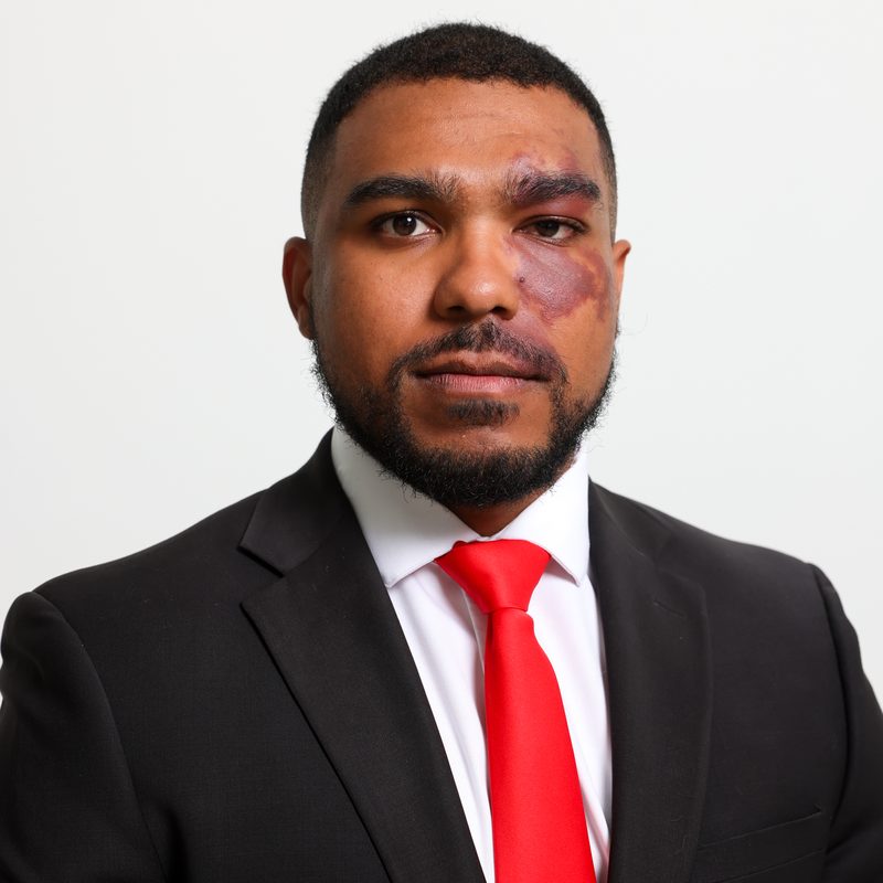 Christopher Schraer, Trial Attorney